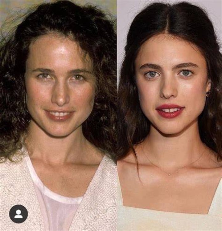 Shocking celebrity faces before and after Khloe Kardashian, Kim